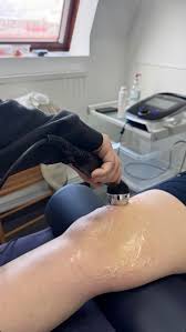 Edema reduction
